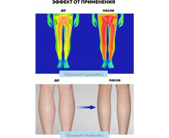 Компрессионный лимфодренажный массажер Planta MFC-80 – изображение 11